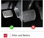 Pedal cover for Tesla Model 3/Y