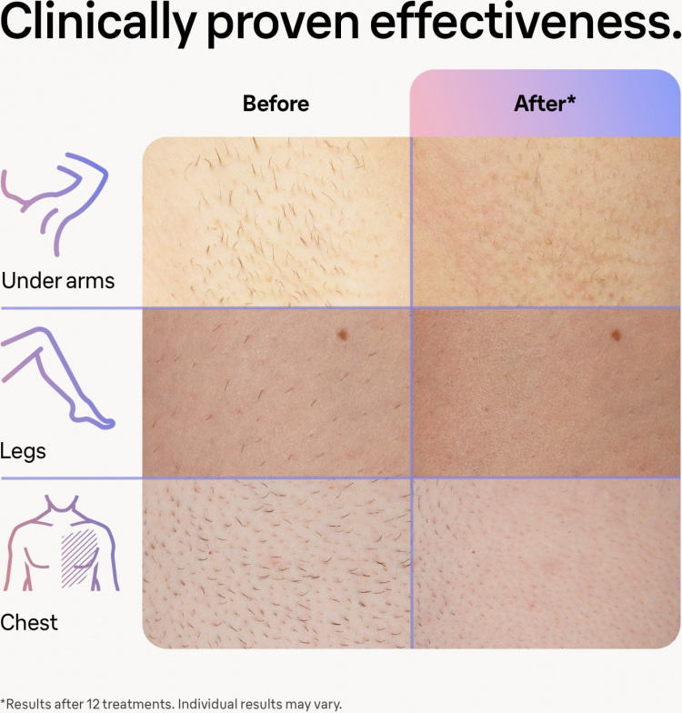 Braun Smart IPL Skin iexpert PL7253 IPL device Braun Smart IPL Skin iexpert PL7253 IPL device