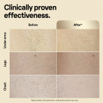 Braun IPL Silk Expert Pro 5 PL5382 IPL device