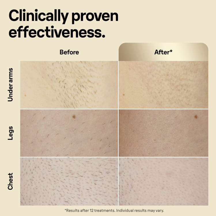 Braun IPL Silk-expert Pro 5 PL5242 IPL device